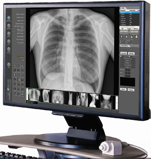 Chiropractic Digital XRay in La Place, LA River Parishes
